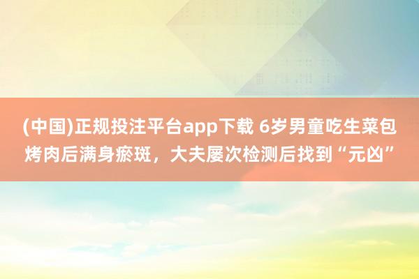 (中国)正规投注平台app下载 6岁男童吃生菜包烤肉后满身瘀斑,大夫屡次检测后找到“元凶”